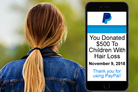 Donation Children With Hair Loss